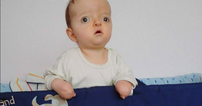 Димитър Ганев е третото бебе в България родено със Синдром