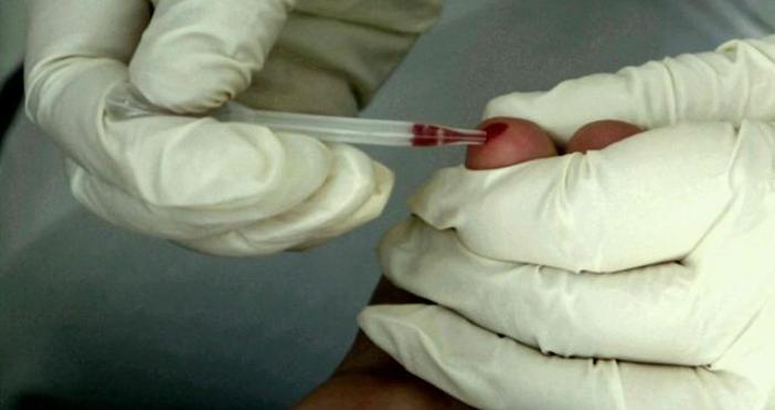 Снимка БулфотоХИВ-инфекцията порази двама души от Бургаска област. Негативната статистика