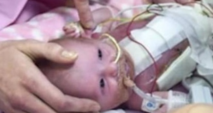 Кадри CNNБритански лекари успешно оперираха новородено чието сърце бе извън