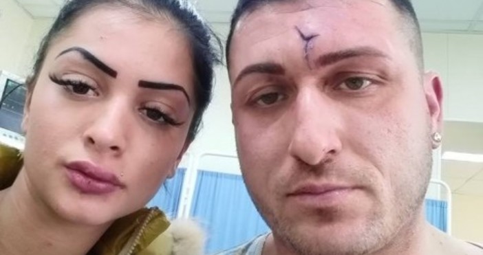 Снимки: ФейсбукВарненец и приятелката му са били нападнати и пребити,