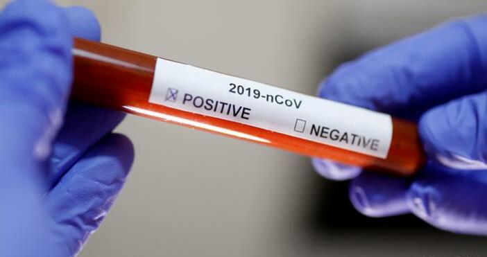 Всички 83 проби, изследвани днес за коронавирус, са отрицателни, съобщиха