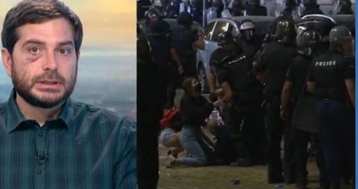 Снимка Булфото Това което видях беше брутална полицейска агресия предизвикана от