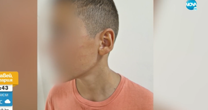 Родители твърдят че бургаски полицай шамаросал сина им  Инцидентът станал в неделя
