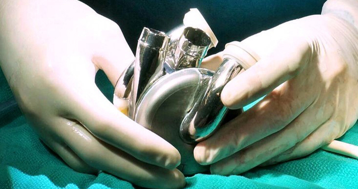 Австралиец живя 100 дни с изкуствено титаниево сърце докато чакаше