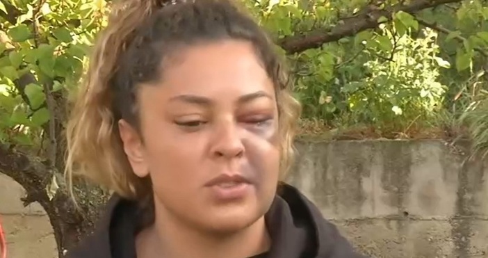 Мъж е бил задържан за побой над 23 годишната си бивша