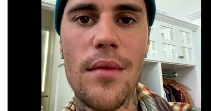 Феновете на Бийбър по цял свят отправят молитви заради състоянието