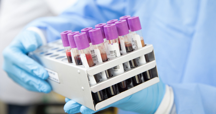 Учени съобщиха че разработен от тях кръвен тест може да