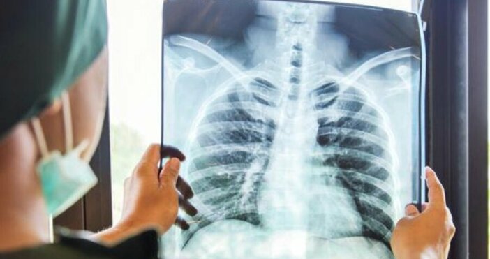 Седем новооткрити случая на туберкулоза има в област Шумен от