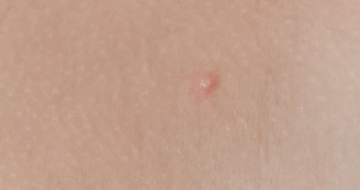 Петел бгЕкспертният съвет по имунология е предложил от препоръчителна имунизацията срещу