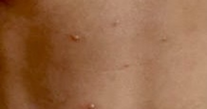 Петел бгДо дни Министерството на здравеопазването официално ще обяви намерението си