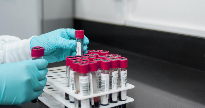 Три случая на заразени със СПИН са открити в Монтанско