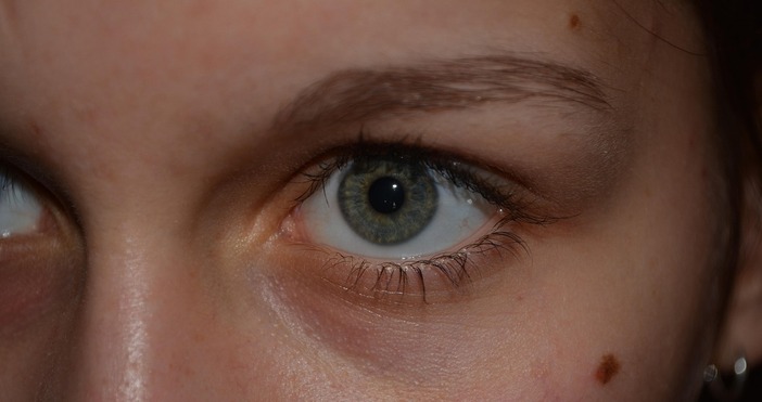 Повечето от нас имат бенки по тялото си но малцина