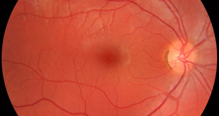  6 декември 1850 г Германският физик Херман фон Хелмхолц който