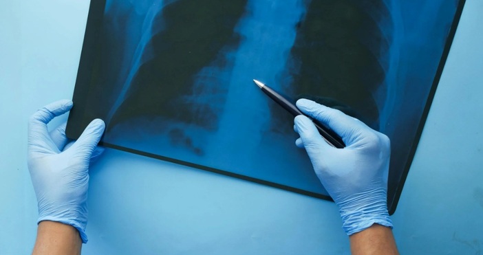 Общо 26 са регистрираните случаи на туберкулоза до края на