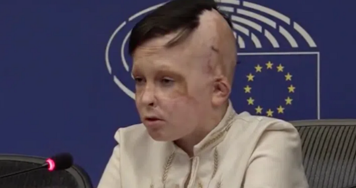 11 годишният украинец Роман Олексиев който оцеля при руска бомбардировка